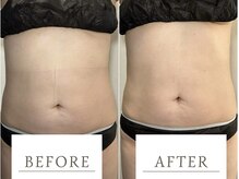 サロン ド ブラン アオヤマ(Salon de BLANC AOYAMA)/腸もみマッサージ/オプション