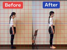 がじゅまる整体院 土浦店/姿勢ビフォーアフター