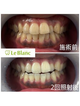 ルブラン 奈良店(Le Blanc)/ますはお試しクーポンで♪