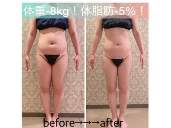 インタークロス(intercross)の写真/≪結果重視の本気痩身≫痩せないあなた…目標体重へ本気ダイエット◇くびれ/ヒップアップ