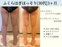 京都フォーエイチ(京都4H)/ふくらはぎ筋ハリ|30代|3ヶ月