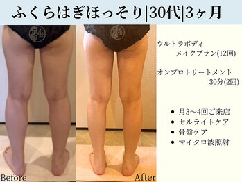 京都フォーエイチ(京都4H)/ふくらはぎ筋ハリ|30代|3ヶ月
