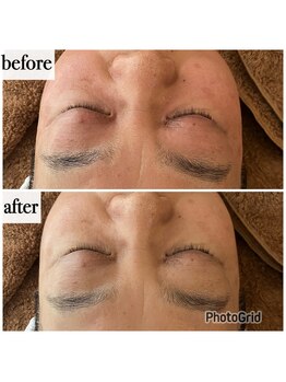 メナードフェイシャルサロン 岐阜茜部/本格エイジングコース