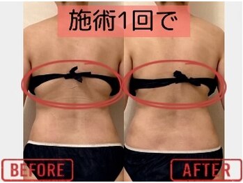 な～る/微弱電流マッサージ