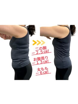 ウィータ とうの鍼灸整骨院(vita)/５０代女性ダイエット