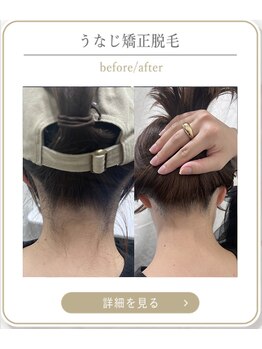 ミース 上野店/プロの技術で美うなじ