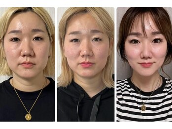 セレーノ(Sereno)の写真/注目の顔の筋トレでフェイスラインをキュッと！たるみ・むくみ改善ほうれい線ケア★