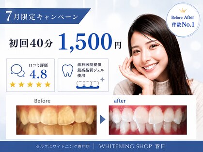 ホワイトニングショップ 福岡春日店の写真