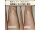 リラ プラス(Lila+)の写真