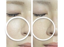 ナナマルニ 高知店(702)/人気★フェイシャルメニュー