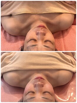 ダーナ(Danam)/首の突っ張りで曲がった顔も◎