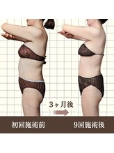 ルマ(Rumah)/筋膜リリース整体で体が薄くなる