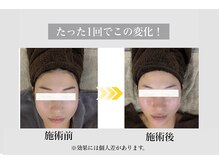 フェイシャルサロン セレスタイト