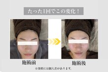 フェイシャルサロン セレスタイト