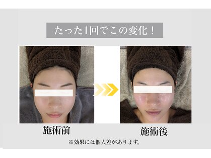 フェイシャルサロン セレスタイトの写真