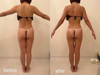 クロレ 浦和店(CLORE)/30代のお客様/5回施術