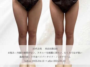 エメ 名古屋栄店(aimer)/BodyCare <痩身・代謝アップ>