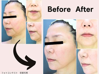 ミネルバエンダモロジー/エンダモロジー/フェイシャル