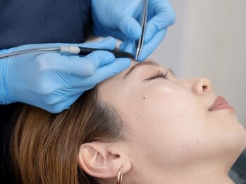 エチ毛ットの写真/美容電気脱毛で【一生ものの眉毛脱毛】サロン通いを卒業したい方に。美眉が手に入るアイブロウケア。