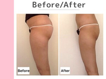 キングスサロン 神戸ハーバーランド店/〈 Before / After 〉