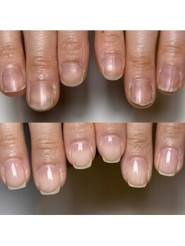 ロイヤル ネイルサロン(Royal nail Saloon)/自爪育成