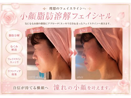 エステティックサロン フェアリー(ESTHETIC SALON FAIRLY)の写真