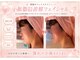 エステティックサロン フェアリー(ESTHETIC SALON FAIRLY)の写真