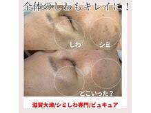 キレイな素肌を目指すならサロンでシミに直接アプローチ！