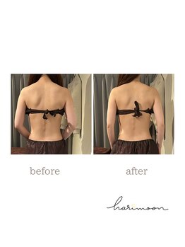 ハリムーン 仙台(harimoon)/美ボディコースビフォーアフター