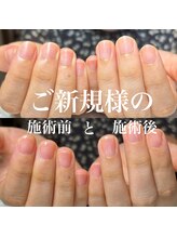 スティラ(Stila)/自爪育成/深爪育成/ネイルケア