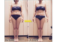 整体 美容サロン フェールラヴィ/【整体+痩身】