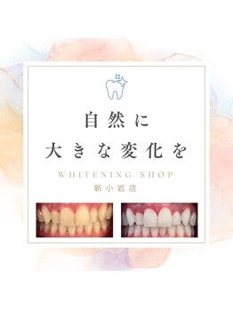 ホワイトニングショップ 新小岩店/歯科提携 ホワイトニング専門店