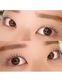 ベリー(BERRY)/お悩みに合わせてデザイン決め!