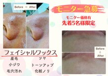 レヴィート(Revept)