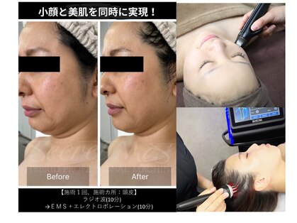 メルシー(Merci)の写真