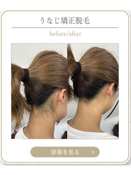 ミース 上野店/うなじケアの効果♪