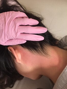 ボニータ(Bonita)/うなじwax脱毛