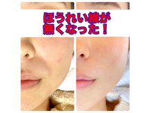 リバイバル(Re:vival)