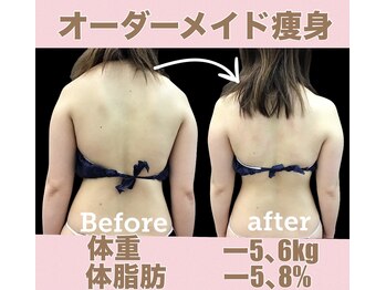 スワン 新栄店(SWAN)/盛り上がった肩背中がフラットに