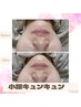 人気NO2【初回お試し】小顔エステ→脂肪分解☆でお顔が半分に?￥7000