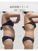 アメリオ(Amelio)/全身筋膜リリース60分2回