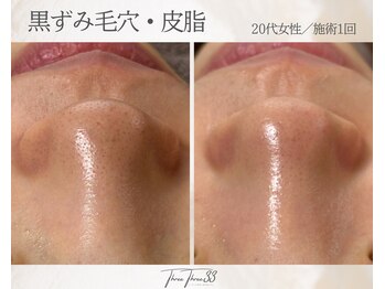 スリースリー(THREE THREE)/毛穴黒ずみ・詰まりケア
