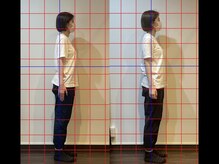 がじゅまる整体院 土浦店/ビフォーアフター