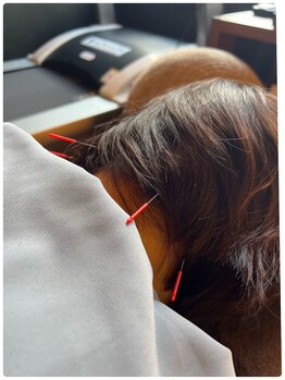 メディカルジャパン 吉祥寺/辛い肩こり、首の痛み