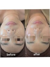 エステサロン エクラ/