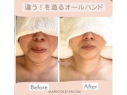 マリーゴールド(marigold)の写真