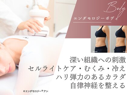 ミネルバ(MINERVA)の写真