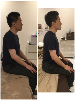 くまのみ整骨院 浦和コルソ院/猫背改善しましょう!