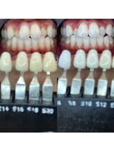 トウキョウスワーズ 池袋店(TOKYO SWRS)/#ホワイトニング #池袋 #渋谷