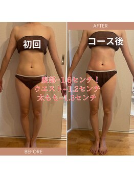 エイミー 藤ヶ丘店(Amy)/before→after